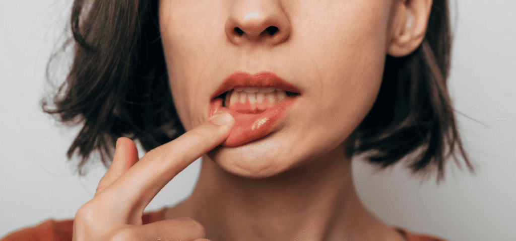 牙肉發炎的症狀 Symptoms of Gum Inflammation