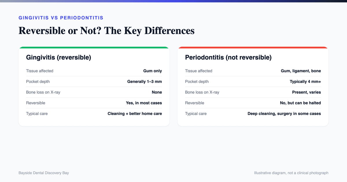 Gingivitis vs periodontitis comparison table