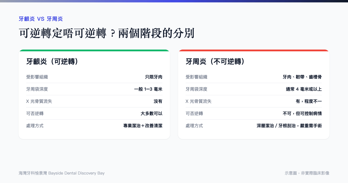 牙齦炎與牙周炎的分別比較表