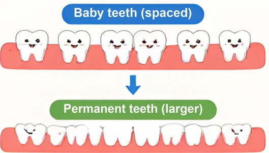 Gaps between baby teeth make room for larger adult teeth