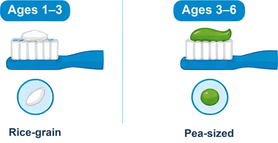 Rice-grain amount of fluoride toothpaste for ages 1–3, pea-sized for ages 3–6